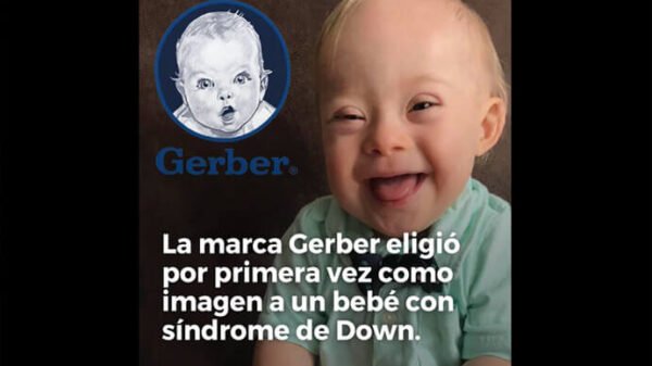 bebé con síndrome de Down Gerber